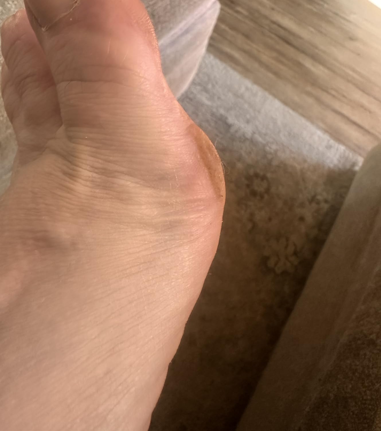 Electric Foot Callus Remover, Rechargeable Foot File for Dead Skin Care customer photo 1