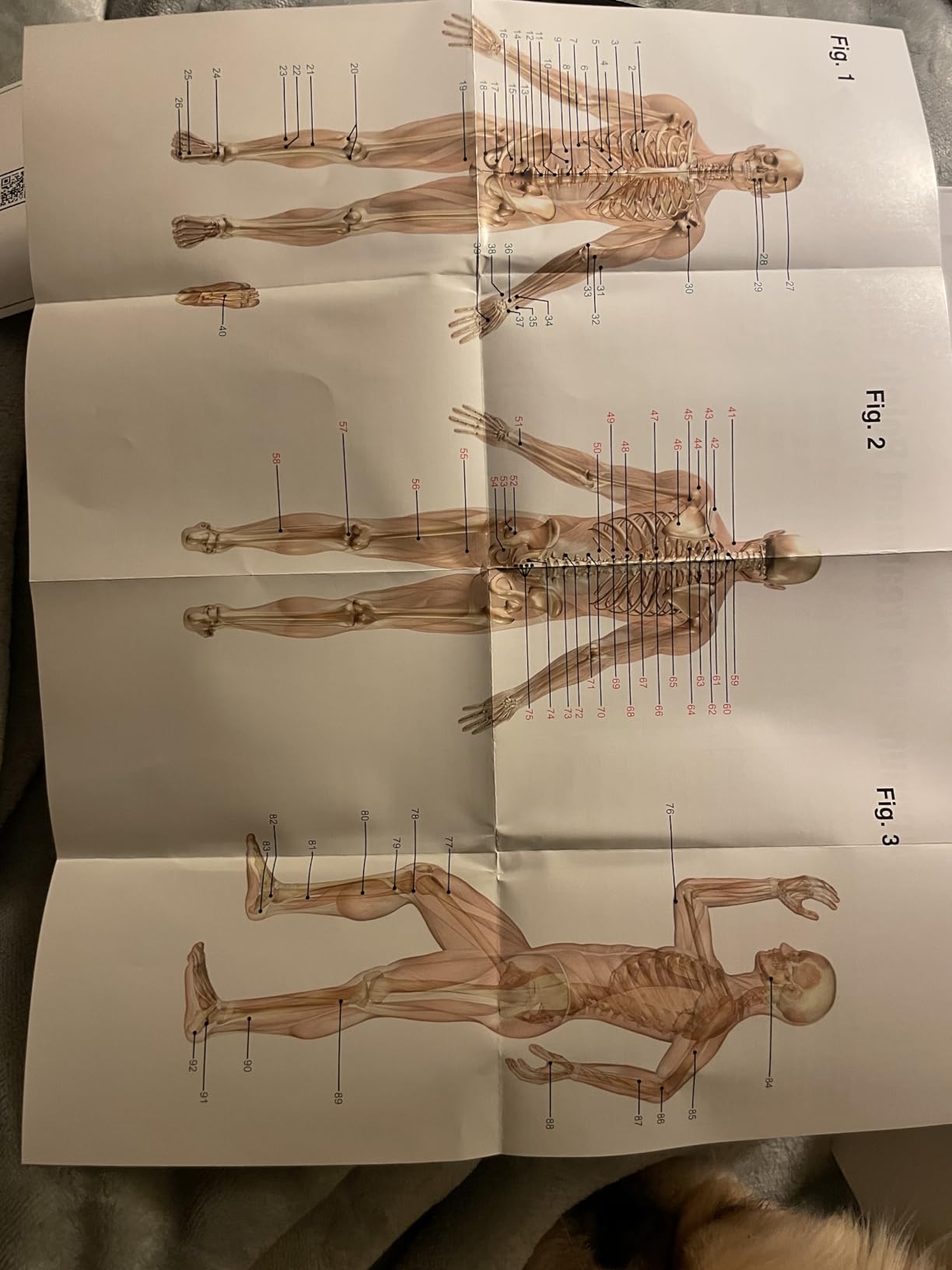 NueMedics Tens Unit Machine Pulse Massager for Pain Relief, 24 Massage Modes, Rechargeable Muscle Stimulator Device with 10 Pads customer photo 1