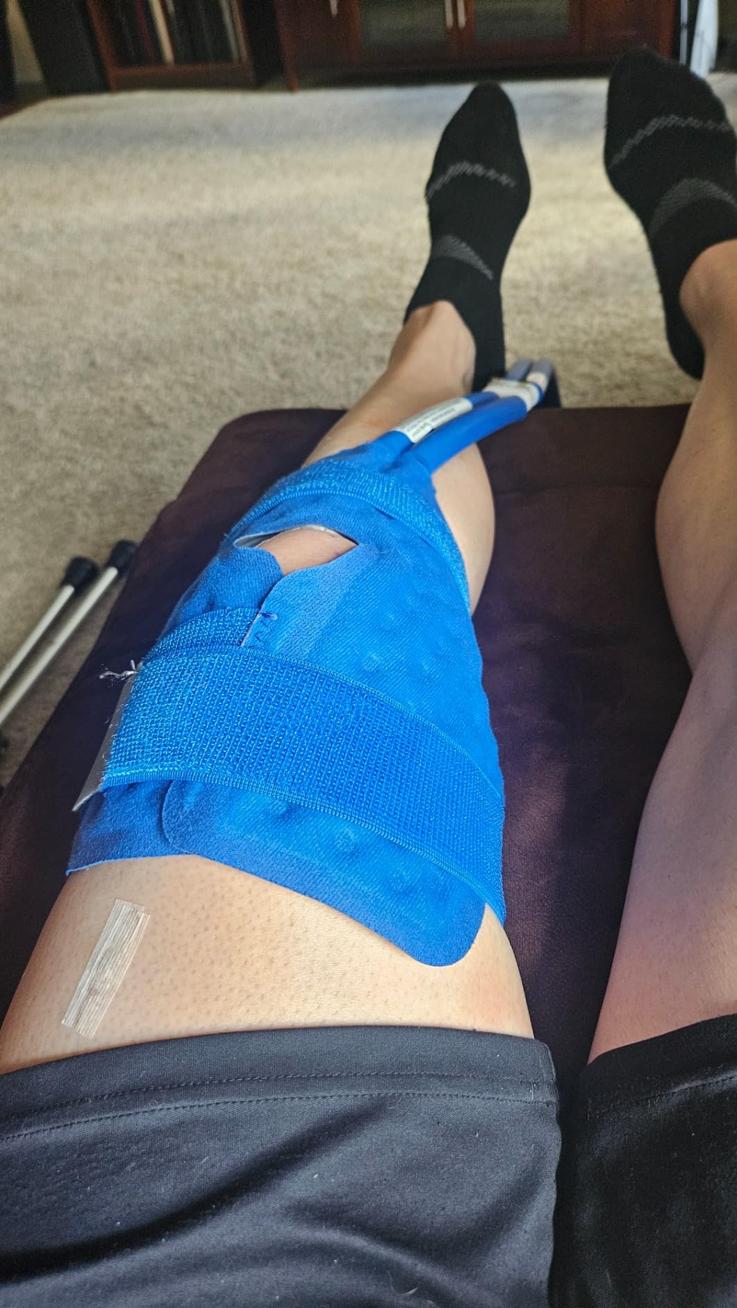 Polar Active Ice 3.0 | 9 QT Cold Therapy Ice Machine | Programmable Timer | Knee & Joint Pad | Cryotherapy Pain Relief System | Ace Bandage Style Compression customer photo 2