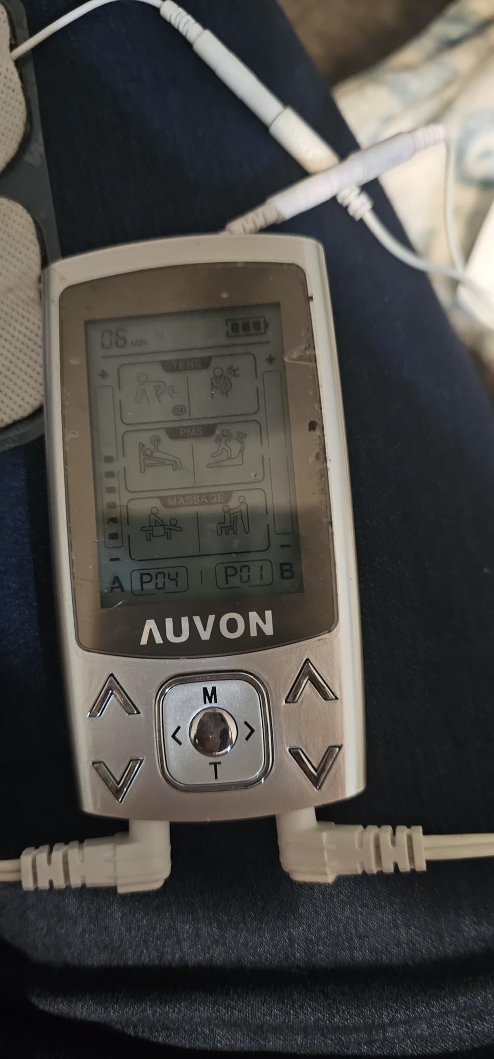 AUVON Dual Channel TENS Unit 24 Modes Muscle Stimulator for Pain Relief,Rechargeable TENS Machine Massager with 12 Pads, ABS Pads Holder, USB Cable and Dust-Proof Storage Bag customer photo 1