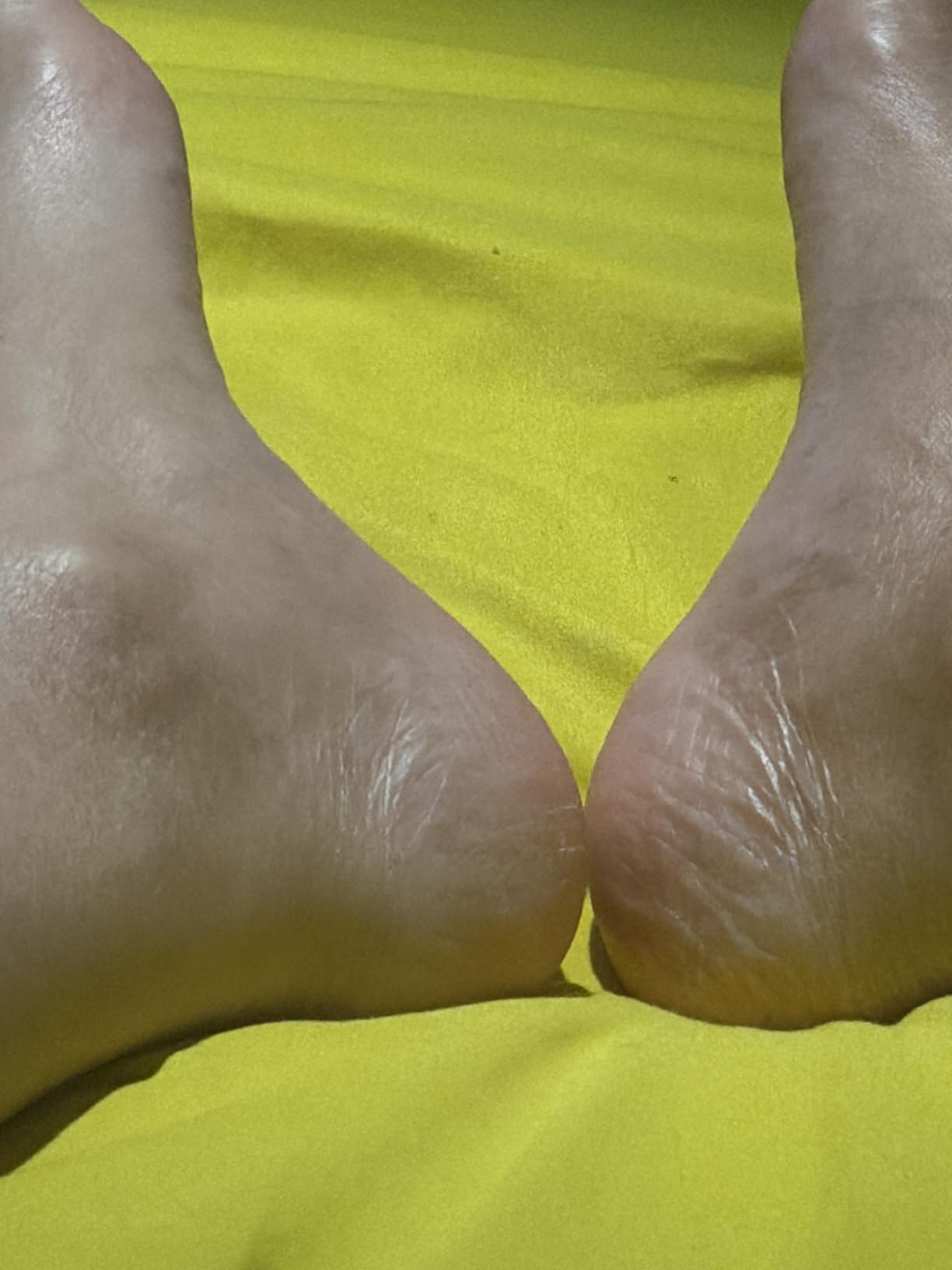 Dr. Scholl's Electric Foot Callus Remover for Feet, Electric Foot File customer photo 2