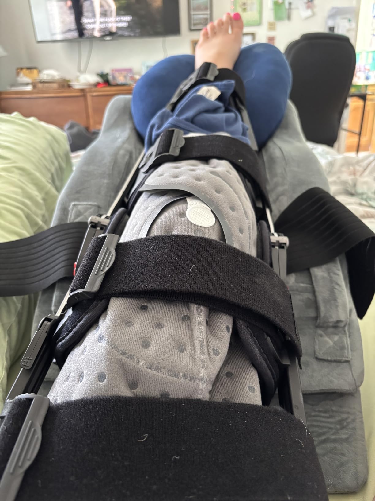 ICYTHRP Programmable Timer Ice Machine for Knee After Surgery w/Quiet Pump customer photo 1