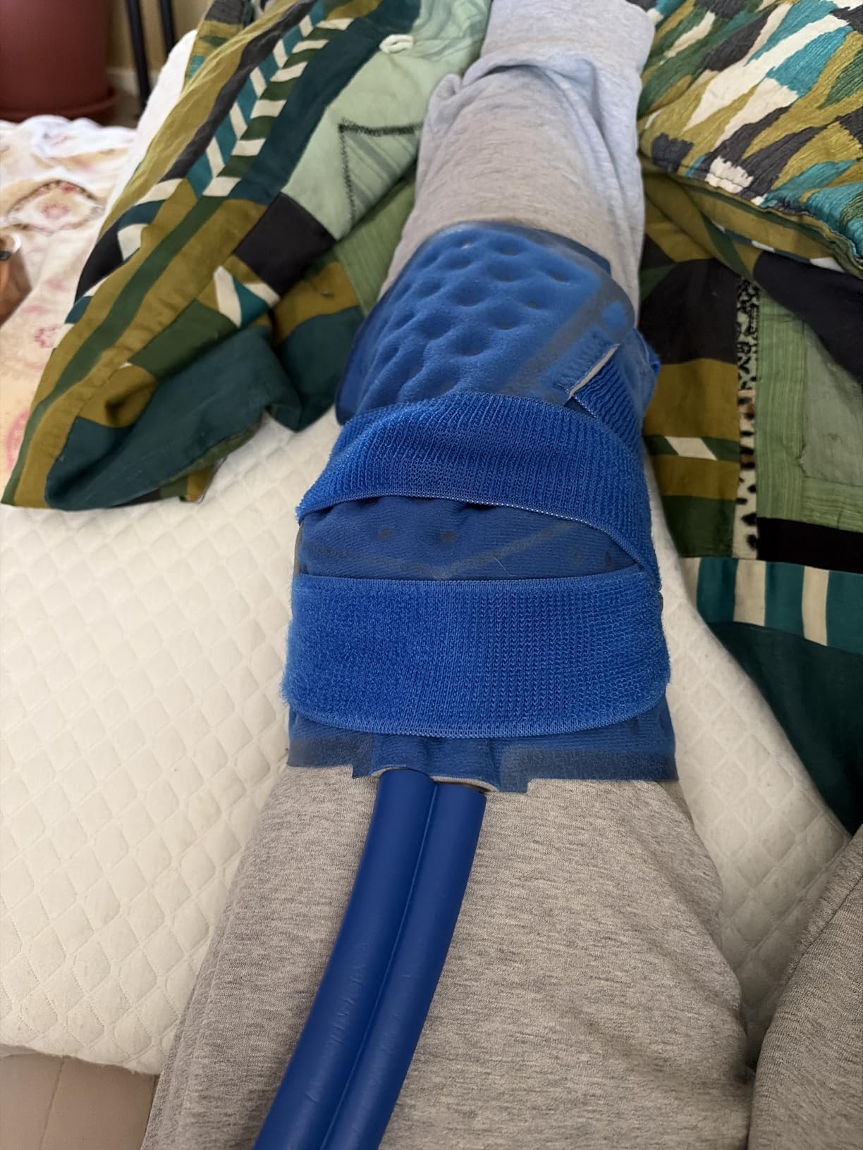 Inmoredo Ice Machine for Knee After Surgery, Cold Therapy Machine for Knee customer photo 1