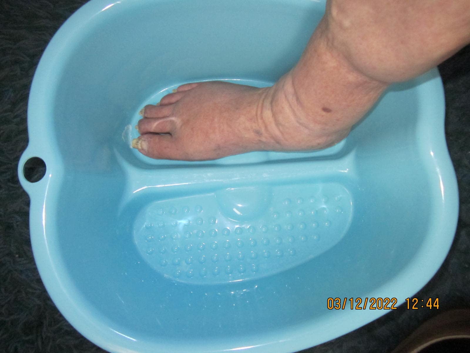 Shiatsu Foot Massager with Heat and Remote Control for Plantar Fasciitis customer photo 2